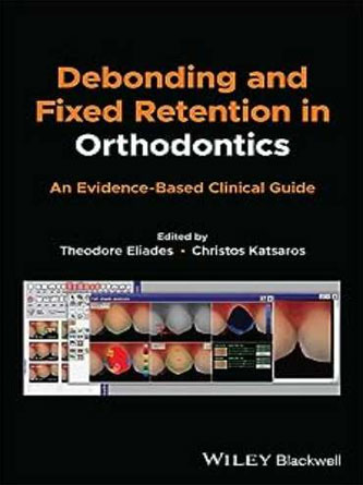 Debonding and Fixed Retention in Orthodontics: An Evidence-Based Clinical Guide (Original PDF)