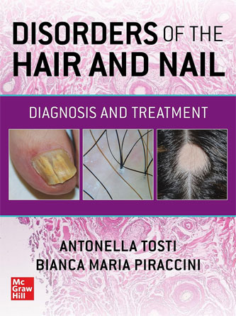 Disorders of the Hair and Nail: Diagnosis and Treatment (Original PDF)