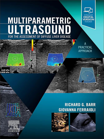 Multiparametric Ultrasound for the Assessment of Diffuse Liver Disease: A Practical Approach (Original PDF)