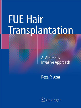 FUE Hair Transplantation: A Minimally Invasive Approach 1st ed. 2019 Edition (PDF Publisher)