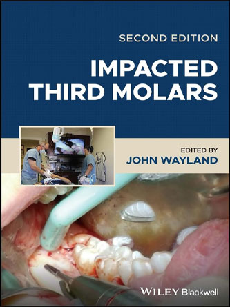 Impacted Third Molars 2nd Edition (Original PDF)