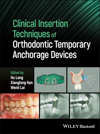 Clinical Insertion Techniques of Orthodontic Temporary Anchorage Devices (Original PDF)