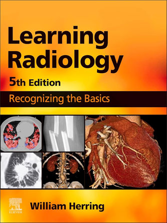 Learning Radiology: Recognizing the Basics 5th Edition (Original PDF + Video)