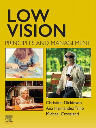 Low Vision: Principles and Management (PDF)