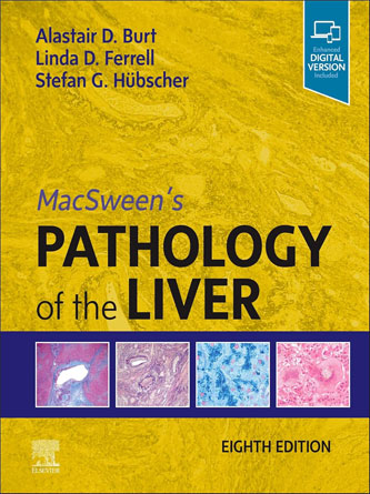 MacSween’s Pathology of the Liver 8th Edition (PDF)