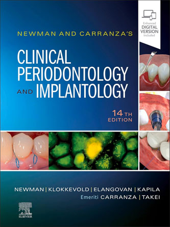 Newman and Carranza’s Clinical Periodontology and Implantology 14th Edition (PDF + Video)