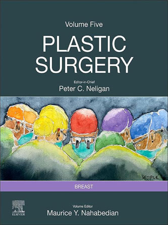 Plastic Surgery: Volume 5: Breast 5th Edition (PDF)