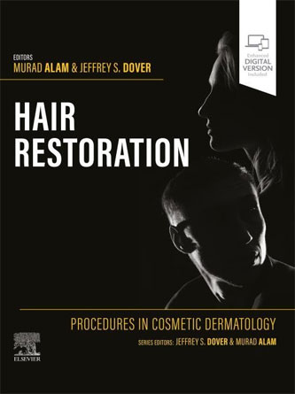 Procedures in Cosmetic Dermatology: Hair Restoration (PDF)