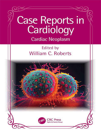 Case Reports in Cardiology: Cardiac Neoplasm (PDF)