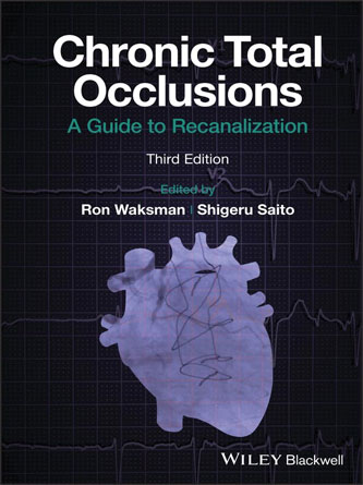 Chronic Total Occlusions: A Guide to Recanalization (PDF)