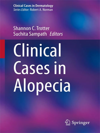 Clinical Cases in Alopecia (Clinical Cases in Dermatology) (PDF)