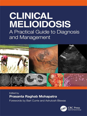 Clinical Melioidosis : A Practical Guide to Diagnosis and Management (PDF)