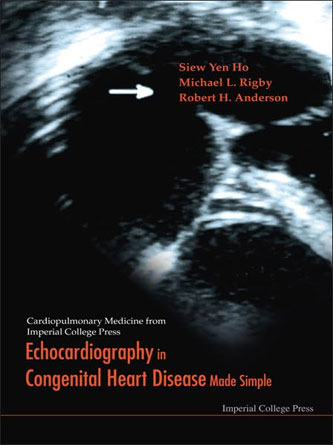 Echocardiography in Congenital Heart Disease Made Simple (PDF)