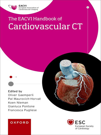 EACVI Handbook of Cardiovascular CT (The European Society of Cardiology Series) (PDF)