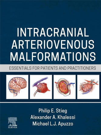 Intracranial Arteriovenous Malformations: Essentials for Patients and Practitioners (Original PDF)