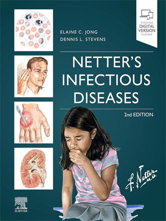 Netter’s Infectious Diseases 2nd Edition (Original PDF)