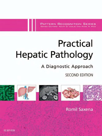 Practical Hepatic Pathology: A Diagnostic Approach 2st Edition (PDF)