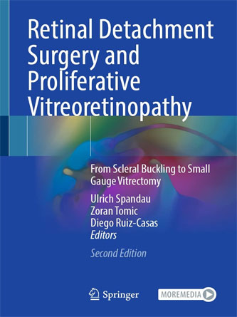 Retinal Detachment Surgery and Proliferative Vitreoretinopathy: From Scleral Buckling to Small Gauge Vitrectomy 2nd Edition (PDF)