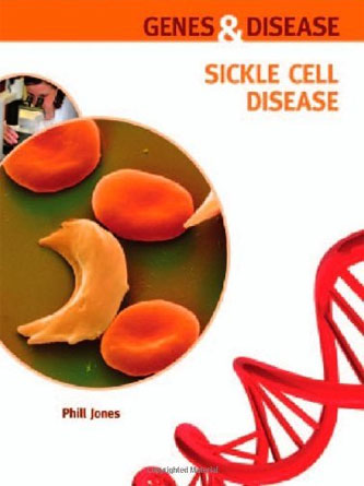 Sickle Cell Disease (Genes and Disease) (PDF)