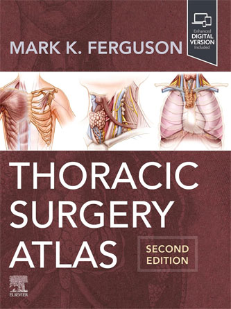 Thoracic Surgery Atlas 2nd Edition (Original PDF)