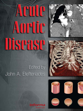 Acute aortic disease (Original PDF)