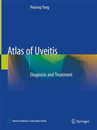 Atlas of Uveitis: Diagnosis and Treatment (PDF)