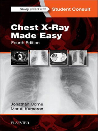 Chest X-Ray Made Easy, 4th Edition (PDF)