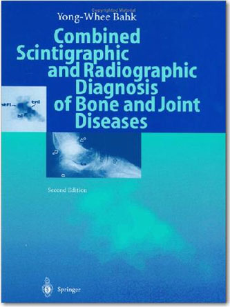 Combined Scintigraphic and Radiographic Diagnosis of Bone and Joint Diseases - PDF