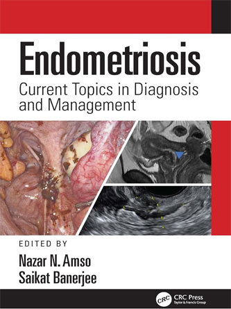 Endometriosis: Current Topics in Diagnosis and Management (PDF)