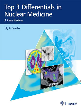 Top 3 Differentials in Nuclear Medicine: A Case Review (EPUB)