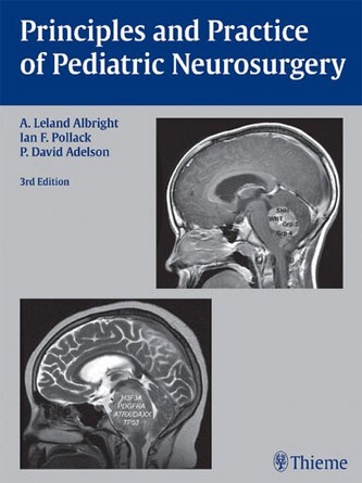 Principles and Practice of Pediatric Neurosurgery 3th Edition (PDF)