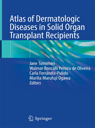 Atlas of Dermatologic Diseases in Solid Organ Transplant Recipients 1st ed. 2022 Edition - PDF