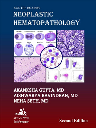 Ace The Boards: Neoplastic Hematopathology (Ace My Path), 2nd edition (Original PDF from Publisher)