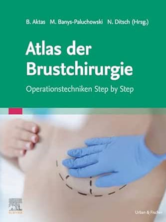 Atlas der Brustchirurgie: Operationstechniken Step by Step (German Edition) (True PDF from Publisher)