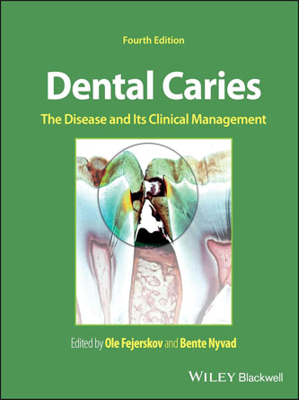 Dental-Caries-Disease-Clinical-Management