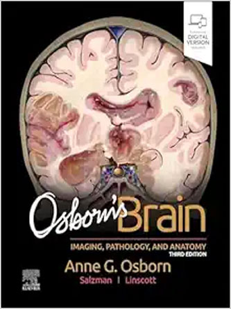 Osborn’s Brain, 3rd Edition (True PDF)