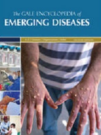 The Gale Encyclopedia of Emerging Diseases, 2nd Edition (Original PDF from Publisher)