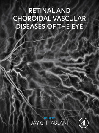 Retinal and Choroidal Vascular Diseases of the Eye (Original PDF from Publisher)