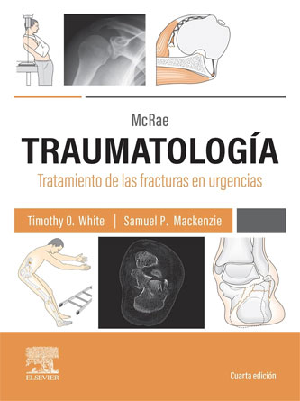 McRae. Traumatología. Tratamiento de las fracturas en urgencias, 4th edition (Original PDF from Publisher)