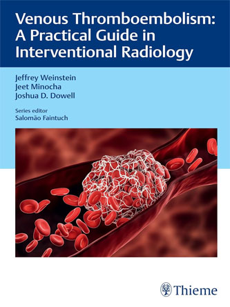 Venous Thromboembolism: A Practical Guide in Interventional Radiology (PDF Publisher)